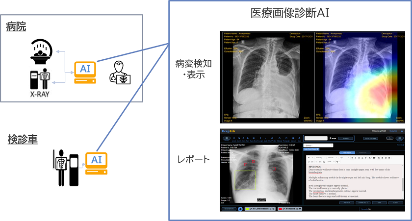 DeepTek社の画像診断AI技術
